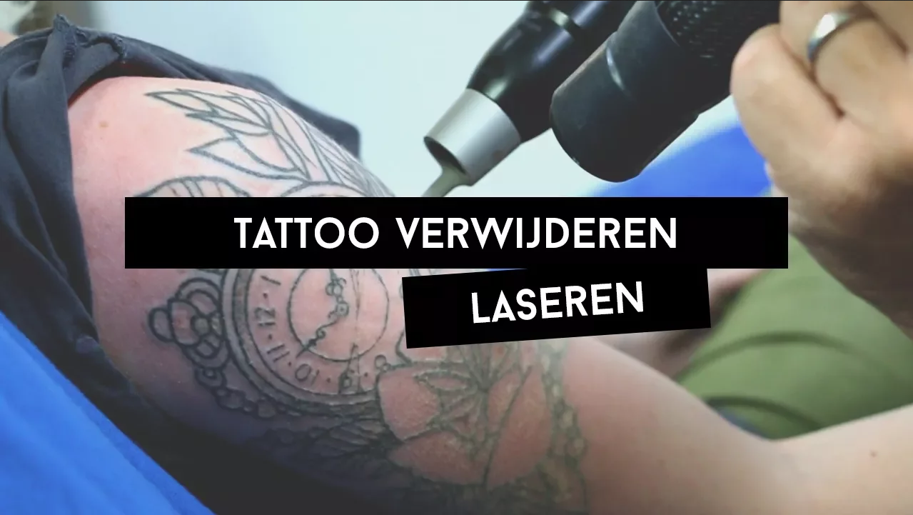 Tattoo verwijderen update